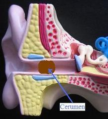 Eliminación de cera en el oído, 🟩 El #tapón de #cera en los #oídos pueden  provocar #PérdidaAuditiva que genera mucha incomodidad y problemas para  socializar correctamente. 👂🏻💦 El