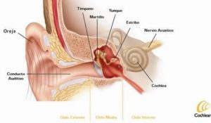 otoesclerosis