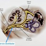 Neuritis vestibular